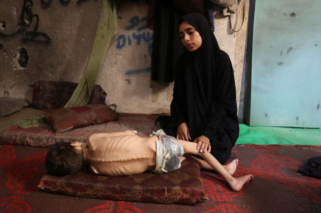 A Palestinian mother sits next to her malnourished son, at a school where they shelter amid a hunger crisis, in Gaza City, July 24, 2025. REUTERS/Mahmoud Issa